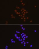 Anti-STAT6 Antibody, clone 4G7J8, Rabbit Monoclonal