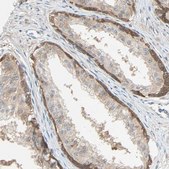 Anti-TNFRSF12A antibody produced in rabbit Prestige Antibodies® Powered by Atlas Antibodies, affinity isolated antibody, buffered aqueous glycerol solution