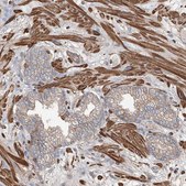 Anti-PIEZO2 antibody produced in rabbit Prestige Antibodies® Powered by Atlas Antibodies, affinity isolated antibody, buffered aqueous glycerol solution