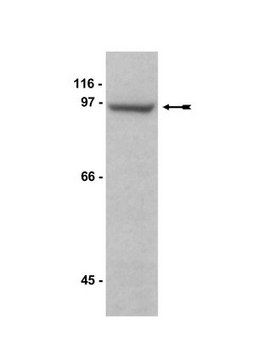 Anti-MAGE-D1/NRAGE Antibody serum, Upstate&#174;