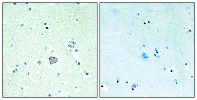 Anti-ADORA2A antibody produced in rabbit affinity isolated antibody