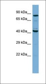 Anti-EZH2 antibody produced in rabbit affinity isolated antibody