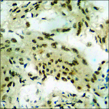 Anti-phospho-GR (pSer203) antibody produced in rabbit affinity isolated antibody