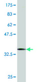 Monoclonal Anti-MARCH9, (C-terminal) antibody produced in mouse clone 2B5, purified immunoglobulin, buffered aqueous solution