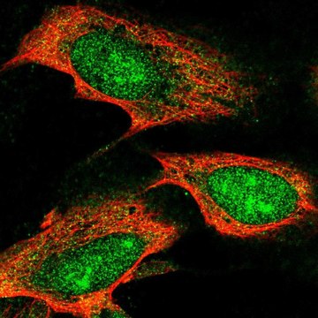 Anti-TTC3 antibody produced in rabbit Prestige Antibodies&#174; Powered by Atlas Antibodies, affinity isolated antibody