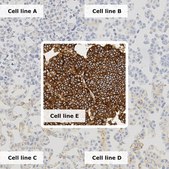 Breast Analyte ControlDR Cell line controls for immunohistochemistry and in situ hybridization