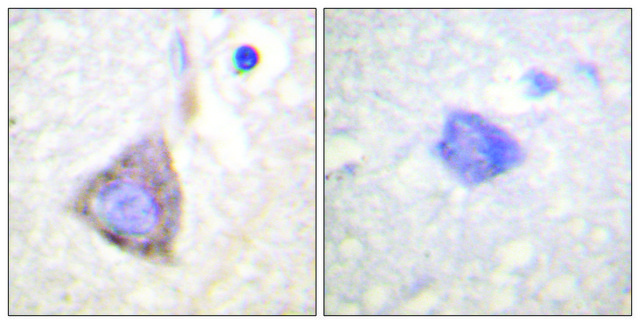 Anti-BCR antibody produced in rabbit affinity isolated antibody