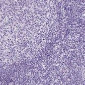 Anti-SP8 antibody produced in rabbit Prestige Antibodies® Powered by Atlas Antibodies, affinity isolated antibody, buffered aqueous glycerol solution