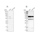 Anti-CROT antibody produced in rabbit Prestige Antibodies® Powered by Atlas Antibodies, affinity isolated antibody, buffered aqueous glycerol solution, Ab2