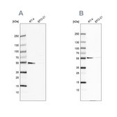 Anti-ATP5A1 antibody produced in rabbit Prestige Antibodies® Powered by Atlas Antibodies, affinity isolated antibody, buffered aqueous glycerol solution