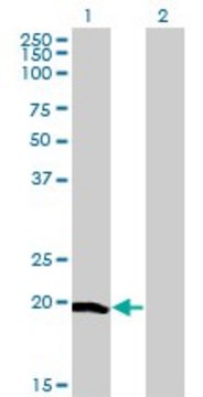 Monoclonal Anti-CETN1 antibody produced in mouse clone 4C12, purified immunoglobulin, buffered aqueous solution