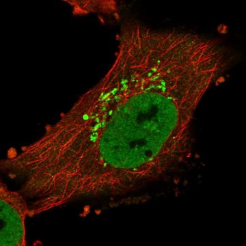 抗-LMX1A 兔抗 Prestige Antibodies&#174; Powered by Atlas Antibodies, affinity isolated antibody, buffered aqueous glycerol solution, ab2