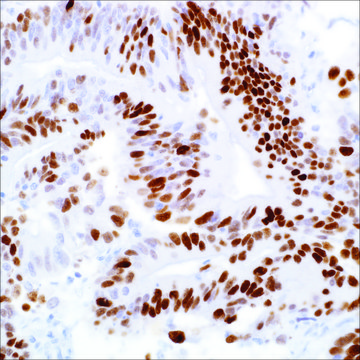 p53 (SP5) Rabbit Monoclonal Antibody