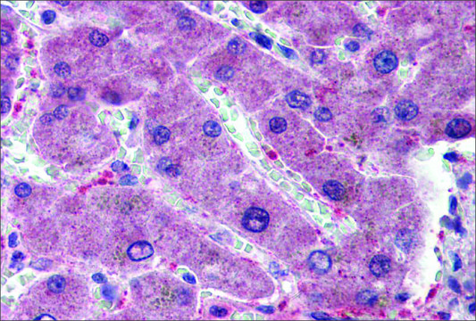 Anti-HYAL1 (ab2) antibody produced in rabbit affinity isolated antibody