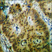 Anti-phospho-Estrogen Receptor-? (pSer87) antibody produced in rabbit affinity isolated antibody
