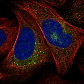 Anti-CTGF antibody produced in rabbit Prestige Antibodies® Powered by Atlas Antibodies, affinity isolated antibody, buffered aqueous glycerol solution, ab1