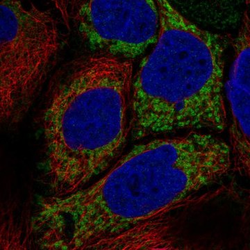 Anti-HKDC1 antibody produced in rabbit Prestige Antibodies&#174; Powered by Atlas Antibodies, affinity isolated antibody