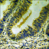 Anti-phospho-Met (pTyr1349) antibody produced in rabbit affinity isolated antibody
