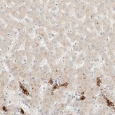 Anti-SARM1 antibody produced in rabbit Prestige Antibodies® Powered by Atlas Antibodies, affinity isolated antibody, buffered aqueous glycerol solution, Ab2