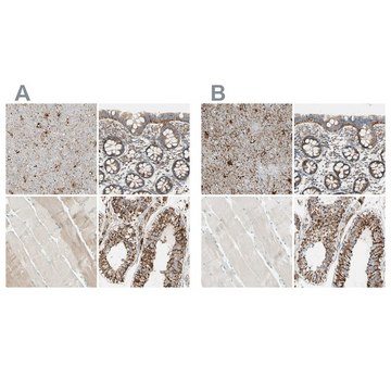 Anti-ARMC10 antibody produced in rabbit Ab1, Prestige Antibodies&#174; Powered by Atlas Antibodies, affinity isolated antibody, buffered aqueous glycerol solution