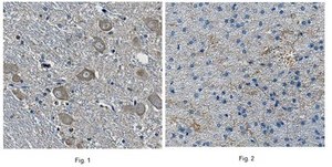 Anti-NB thymosin beta (TMSB15A Antibody), Clone 4A6.3 clone 4A6.3, from mouse