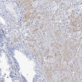 Anti-MOXD1 antibody produced in rabbit Prestige Antibodies® Powered by Atlas Antibodies, affinity isolated antibody, buffered aqueous glycerol solution