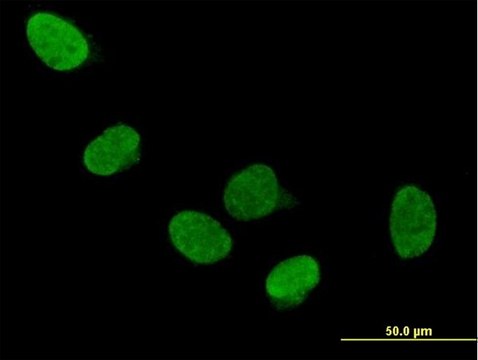 Anti-DDX5 antibody produced in mouse purified immunoglobulin, buffered aqueous solution