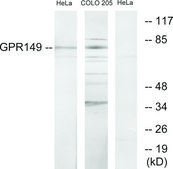 Anti-GPR149 antibody produced in rabbit affinity isolated antibody