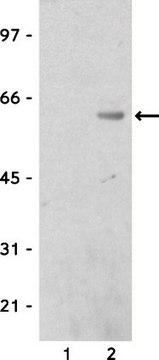 Anti-Calmodulin Binding Protein Epitope Tag Antibody Upstate&#174;, from rabbit