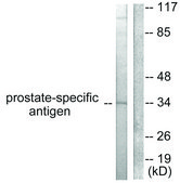 Anti-Prostate-specific Antigen antibody produced in rabbit affinity isolated antibody