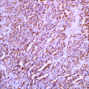 CD31 (EP78) Rabbit Monoclonal Primary Antibody