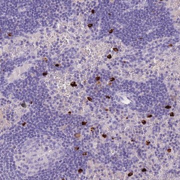 Anti-TPSD1 antibody produced in rabbit Prestige Antibodies&#174; Powered by Atlas Antibodies, affinity isolated antibody, buffered aqueous glycerol solution