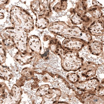 Anti-PARP14 antibody produced in rabbit Prestige Antibodies&#174; Powered by Atlas Antibodies, affinity isolated antibody, buffered aqueous glycerol solution