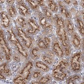 Anti-SEC23IP antibody produced in rabbit Prestige Antibodies® Powered by Atlas Antibodies, affinity isolated antibody, buffered aqueous glycerol solution