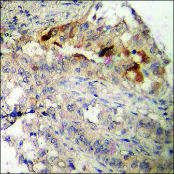 Anti-phospho-Akt1 S1 (pThr246) antibody produced in rabbit affinity isolated antibody