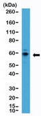 Anti-p70S6K Rabbit Monoclonal Antibody clone RM438, affinity purified immunoglobulin