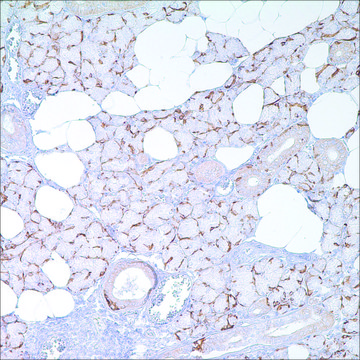 Cytokeratin 14 (LL002) Mouse Monoclonal Antibody