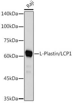 Anti-L-Plastin/LCP1 Antibody, clone 3T0M1, Rabbit Monoclonal