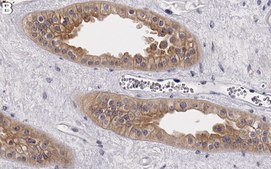 Anti-Pyk2/PTK2B Antibody, clone 3B7 ZooMAb® Rabbit Monoclonal recombinant, expressed in HEK 293 cells