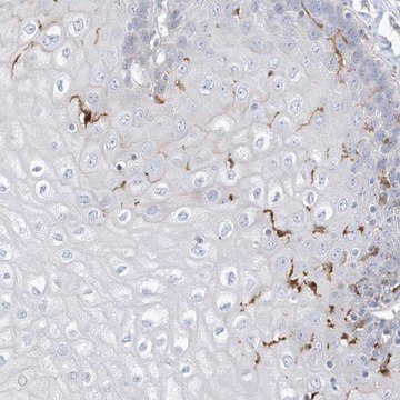 Anti-ATP13A1 antibody produced in rabbit Prestige Antibodies&#174; Powered by Atlas Antibodies, affinity isolated antibody, buffered aqueous glycerol solution