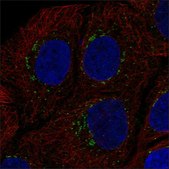 Anti-NOXA1 antibody produced in rabbit Prestige Antibodies® Powered by Atlas Antibodies, affinity isolated antibody, buffered aqueous glycerol solution