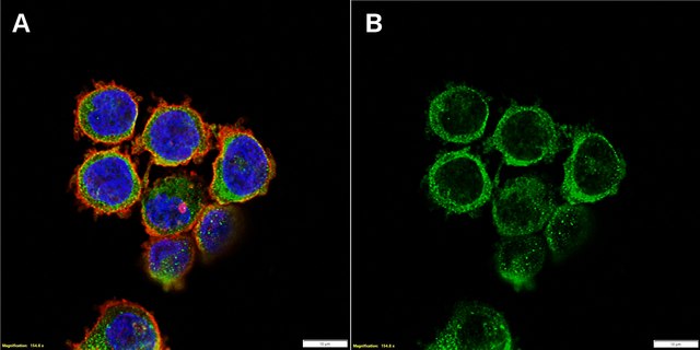 Anti-TREM-2 Antibody, clone 1I11 ZooMAb&#174; Rabbit Monoclonal recombinant, expressed in HEK 293 cells