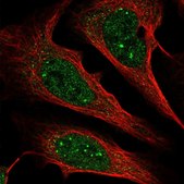 Anti-ZCCHC12 antibody produced in rabbit Prestige Antibodies® Powered by Atlas Antibodies, affinity isolated antibody, buffered aqueous glycerol solution
