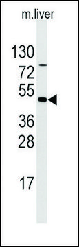 Anti-ULK3 (center) antibody produced in rabbit Ig fraction of antiserum, buffered aqueous solution