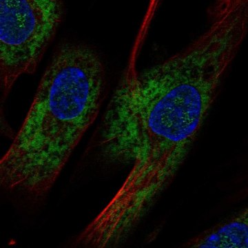 Anti-OMD antibody produced in rabbit Prestige Antibodies&#174; Powered by Atlas Antibodies, affinity isolated antibody