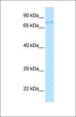 Anti-IGF1R antibody produced in rabbit affinity isolated antibody