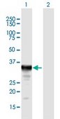Anti-SULT1E1 antibody produced in mouse IgG fraction of antiserum, buffered aqueous solution