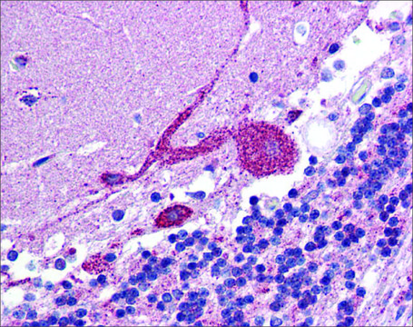 Anti-ARF6 antibody produced in rabbit affinity isolated antibody