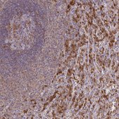 Anti-PYCARD antibody produced in rabbit Prestige Antibodies® Powered by Atlas Antibodies, affinity isolated antibody, buffered aqueous glycerol solution