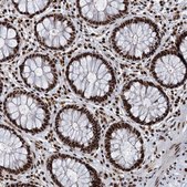 Anti-RBM26 antibody produced in rabbit Prestige Antibodies® Powered by Atlas Antibodies, affinity isolated antibody, buffered aqueous glycerol solution